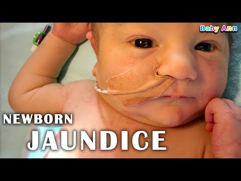 NEWBORN JAUNDICE || Understanding Newborn Jaundice || What is Jaundice? || How to identify Jaundice