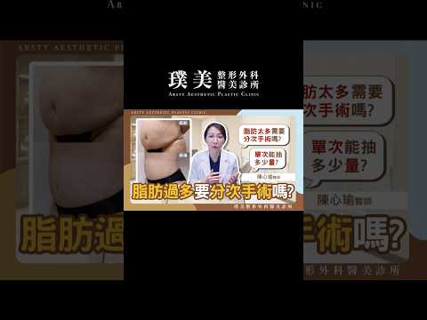 脂肪過多要分次手術嗎? #抽脂 #減肥