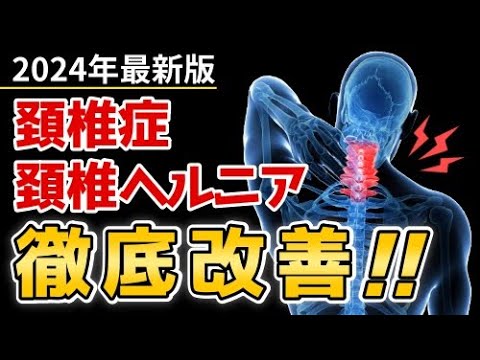 【2024年最新】頚椎症・頚椎ヘルニア徹底改善