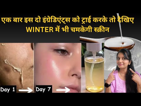 Why Dark Skin in Winter | How to cure Winter Dark Skin Problem| Winter Skincare kaise kare