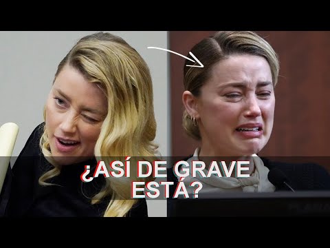 DIAGNÓSTICO DEFINITIVO DE AMBER HEARD Y SUS TRASTORNOS | caso Johnny Depp y Amber Heard | Ness