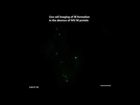 Nipah virus induces two inclusion body populations: Identification of novel inclusions at the plasma