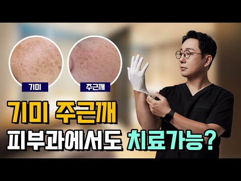 진한 기미랑 주근깨도 제거할 수 있나요? │기미 주근깨