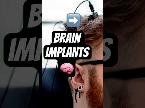 Brain implants?