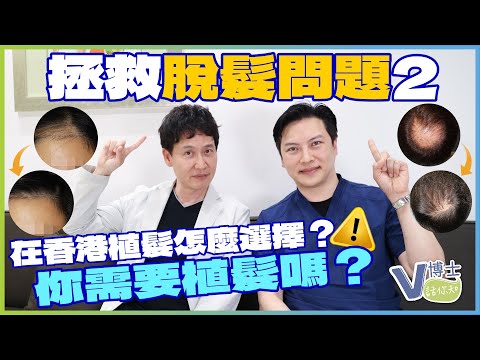 拯救脫髮問題2 在香港植髮怎麼選擇？你需要植髮嗎？｜ft.林博士【V博士話你知】