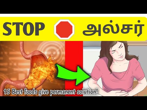 Stomach ulcer treatment in tamil/stomach ulcer symptoms in tamil/stomach ulcer treatment tamil