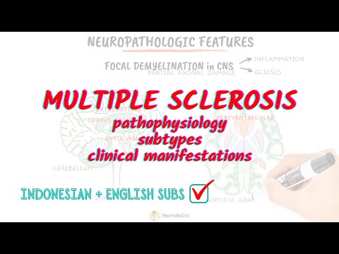 Multiple Sclerosis (Pathophysiology, Subtypes, Clinical Manifestations) | Neuroaholics