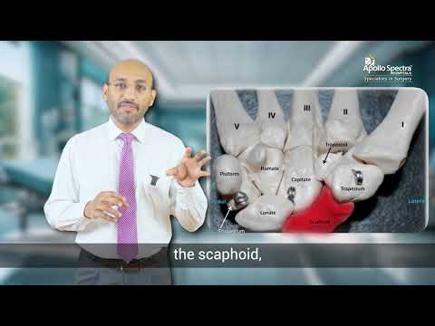 Scaphoid Fracture - A brief overview by Dr. Darshan Jain