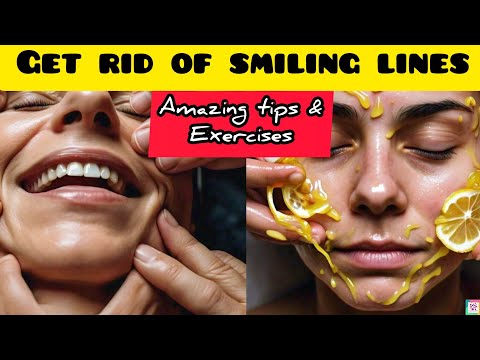 Smiling Lines Removal | How to Get Rid Of Smile Lines| Laugh Lines | Smile Lines #smilelines #howto