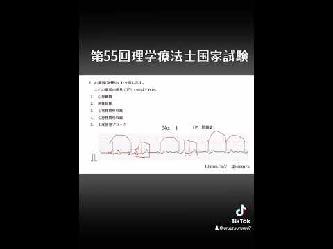 この心電図わかりますか？