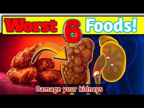 06 Worst foods damage your kidneys | kidney disease foods to avoid | kidney disease |STAR LABORATORY