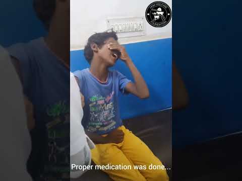 treatment of dog bite student by HNM team which is ignored by his uneducated parents #viral #like