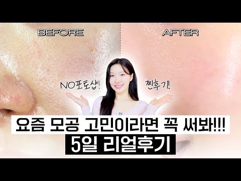 cc) 모공에 효과보고 싶다면!?🔥저도 궁금해서 5일동안 써보고 비교해봤습니다!!ㅣ아랑