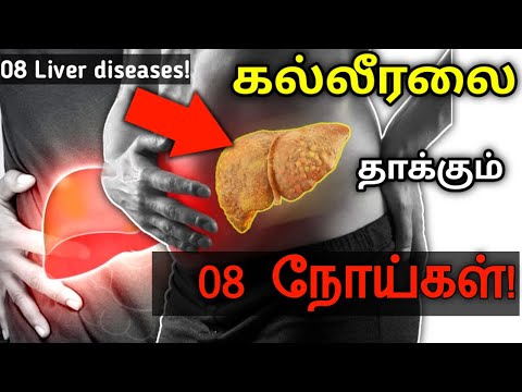 கல்லீரலை பொதுவாக தாக்கும் 08 நோய்கள் | 08 Common liver diseases in tamil | Liver problems in tamil