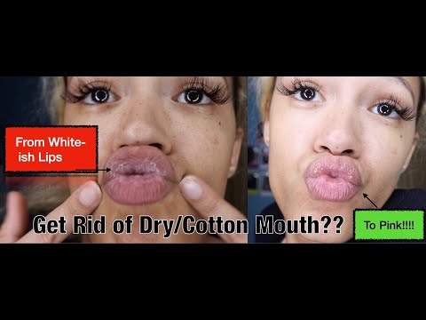 No More Dry Lips!!!