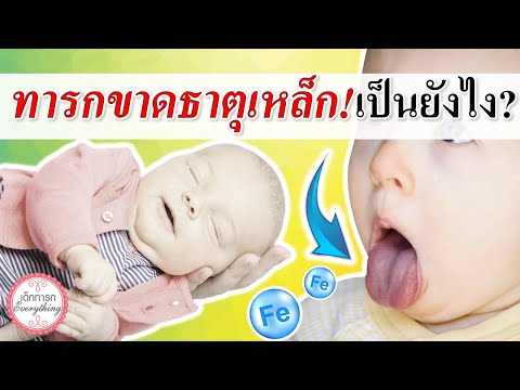 อาการทารก : ทารกขาดธาตุเหล็ก เป็นอย่างไร? | อาการเด็กทารก | เด็กทารก Everything