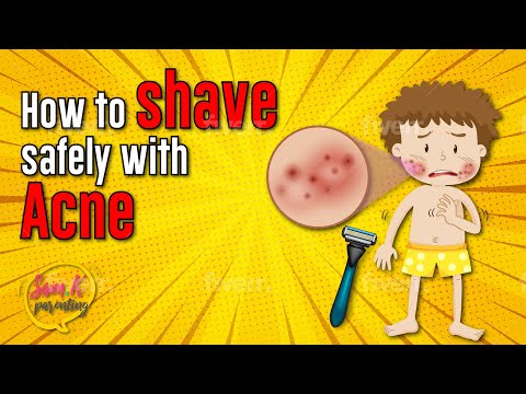 Puberty for Boys Stages 🪒 How to shave safely with acne ✅