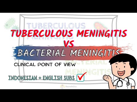 Tuberculous vs bacterial meningitis | Neuroaholics