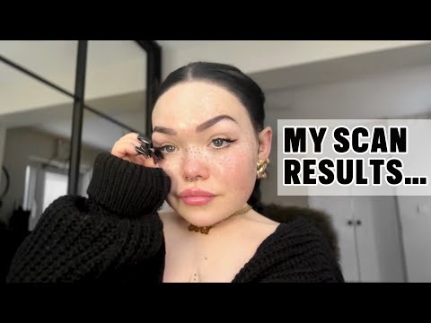 HEALTH UPDATE…My SCAN RESULTS😬 | Life Diaries | Georgia Rankin