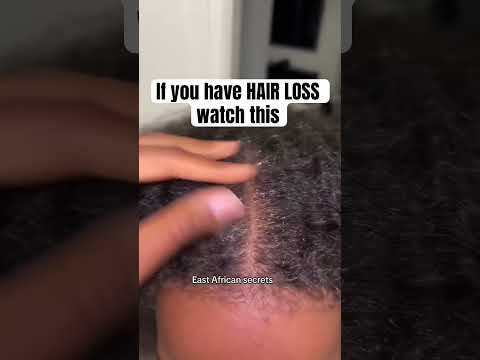 If you have hair loss watch this eastafricansecrets.com #hairgrowth #blackgirlmagic #longhair