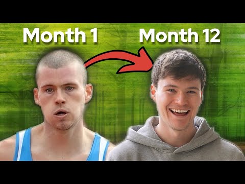 How I regrew my balding hair with 3 proven Treatments FAST! (with progress pictures)