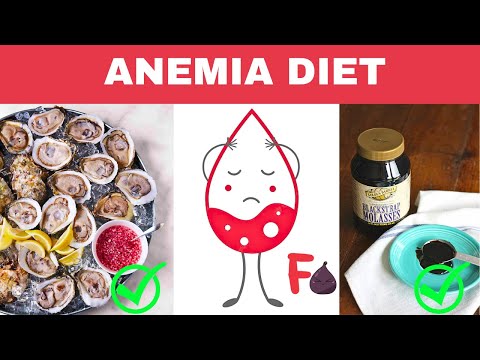 Anemic Diet Guide - The Top 10 Iron Rich Foods for Anemia Treatment | Iron Deficiency