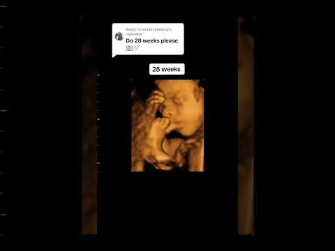 28 weeks baby inisde womb 5d ultrasound scan #28weekspregnant #5dultrasound