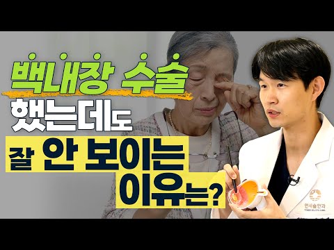 백내장 수술 후에 잘 안 보이고 불편한 이유, 바로 ‘이것’ 때문입니다! - 솔직한 안과 #6