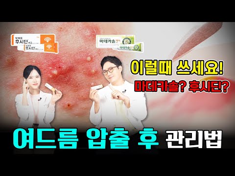 여드름 짜고 후시딘? 마데카솔? 여드름패치? 올바른 여드름압출 후 관리방법!