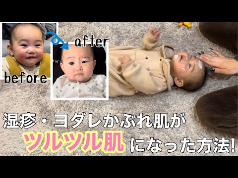 真っ赤っかのほっぺがツルツルスベスベ肌になった方法！