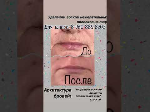 Удаление нежелательных волосков на лице. Телефон для записи: 89608858202, г. Ахтубинск.