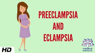 Preeclampsia and Eclampsia, Causes, Signs and Symptoms, Diagnosis and Treatment.