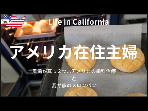 【アメリカ在住主婦】奥歯が真っ２つ...アメリカの歯科治療｜我が家のメロンパン｜カリフォルニア生活