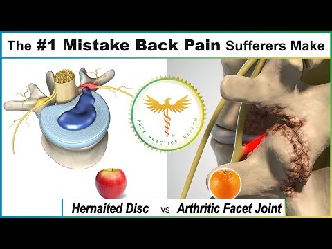 The #1 Mistake Most People Suffering from Back Pain Make