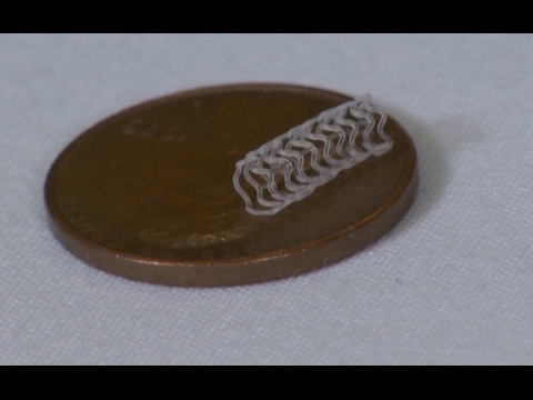 Innovation: Dissolvable Heart Stents