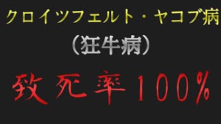 クロイツフェルト・ヤコブ病について紹介　致死率は100%です