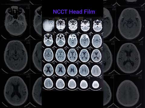 NCCT Head Film