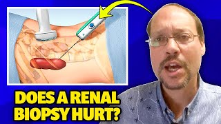 How Much Does A Renal Biopsy Hurt?