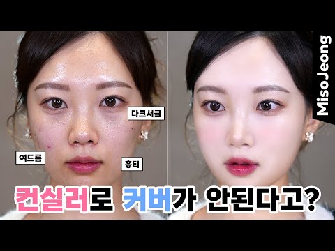 Acne Skin Cover Makeup👍🏻 (How to choose blemishes cover concealer)