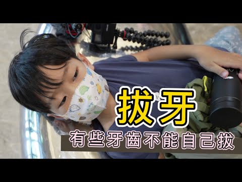 【拔牙齒】恆牙長出來，乳牙卻未鬆動