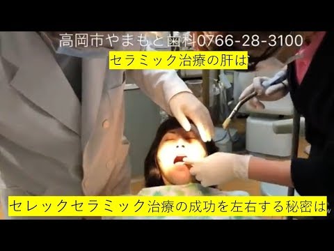 セレックセラミックによる虫歯治療富山県高岡市やまもと歯科