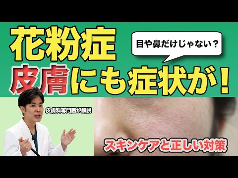 花粉症は肌にも症状が！スキンケアと正しい対策