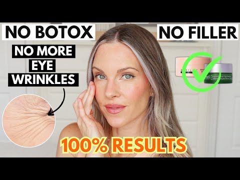 I DISCOVERED 5 SKINCARE PRODUCTS TO PREVENT AND TREAT EYE WRINKLES WITHOUT INJECTABLES OR BOTOX