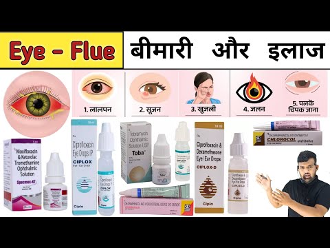 Eye Flue | Conjunctivitis | Eye flue Treatment | Conjunctivitis Treatment | Eye drops | Medicine