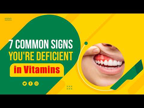 Signs You are deficient in Vitamins: Mouth Ulcers, Night Blindness, Excessive Fatigue, Hair Loss