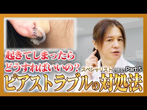 【ピアス】ピアストラブルが起きてしまったら！？良い病院の見つけ方とは！？ピアスについて語る！第5話！！