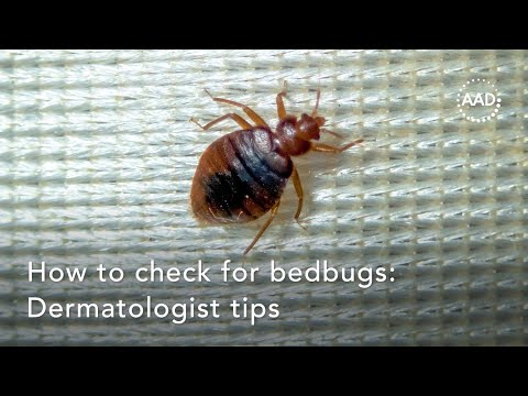 How to check for bedbugs: Dermatologist tips