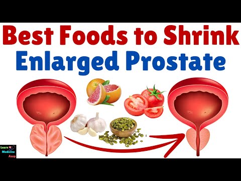 Best Foods to Shrink an Enlarged Prostate | Foods That Can Help You Get Rid of an Enlarged Prostate