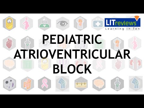 Atrioventricular Block