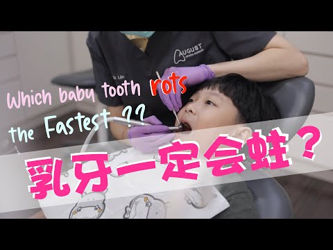 EP 22 : 小孩乳牙一定会蛀吗？Which tooth rots the fastest?